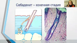 Шелушится и корками покрывается. Лекция по ветеринарной дерматологии.