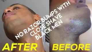 How to shave and not get razor bumps while black