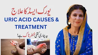 Uric acid ko kaise control kare | Uric acid home treatment  By Dr. Bilquis Shaikh