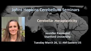 Jennifer Raymond: Cerebellar metaplasticity