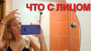 LIFE VLOG: УЖАС - Что с моим Лицом?! Почему Лика Плачет? Отбирают Телефон!