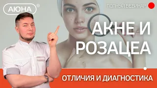 Акне или розацеа? Отличия и диагностика