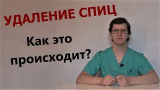 Удаление спиц