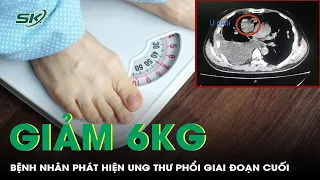 Phát Hiện Ung Thư Phổi Giai Đoạn Cuối Sau Khi Giảm 6kg | SKĐS