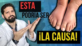 ¡MIRA! ¿Por qué tus PIERNAS  se HINCHAN? ¡Descubre las posibles causas y SOLUCIONES!✅