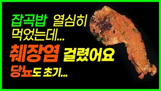 잡곡밥 때문에 치매와 암 걸릴수 있어요.현미 잡곡밥은 꼭 이렇게 드셔야 됩니다.현미에 있는 독소 제거하는 방법    #현미 #건강 #건강정보 #신장   #췌장  #잡곡 #치매 #암