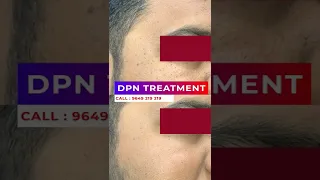 At Last, The Secret To DPN TREATMENT Is Revealed | Viral #shorts
