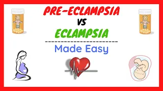 Preeclampsia and Eclampsia, Preeclampsia in Pregnancy, Symptoms, Pathophysiology, Treatment