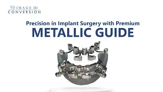 Full mouth Rehabilitation with Premium metallic Guide | Guided Implant Surgery