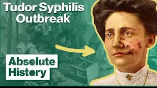 History of syphilis