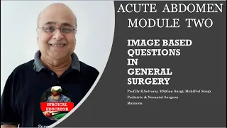 ACUTE ABDOMEN – Module 2- Case/Image Based Discussion