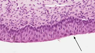 Histology of the Urinary Bladder