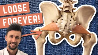 How to Permanently Loosen a Tight Piriformis!