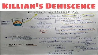 Killians Dehiscence | Pharynx Anatomy | Head and Neck Anatomy | TCML