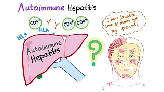 Autoimmune Hepatitis (Lupoid hepatitis)