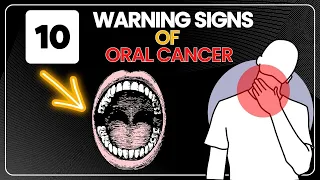 10 Warning Signs of Oral Cancer - Symptoms of Oral Cancer