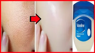 Apply Vaseline On Your Skin and See The Magic || Amazing 5 Vaseline Beauty Hacks | Beauty | Hacks