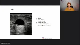 УЗИ молочных желез и лимфоузлов с примерами
