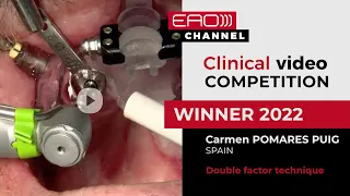 Double factor technique w/ Carmen Pomares Puig | EAO Clinical video