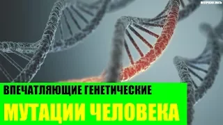 Впечатляющие генетические мутации человека