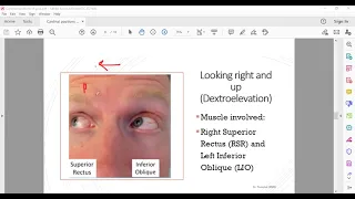 cardinal positions of gaze