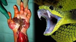 10 Most Poisonous & Dangerous Snakes in the World | Venomous Snakes In The World