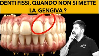 Dr Palmas: quando non si deve mettere la gengiva finta ?