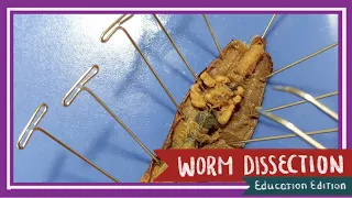 Worm Dissection || What are Worms Hiding Underneath Their Skin? [EDU]