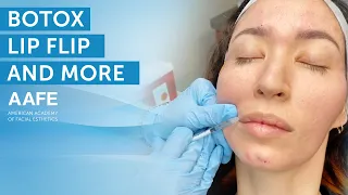 Botox Lip Flip Treatment + More | AAFE