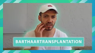 Raymonds Barthaartransplantation | Update nach 8 Monaten