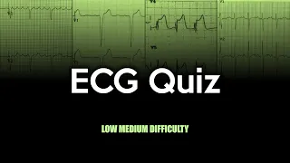 ECG Quiz: Low to Medium Difficulty