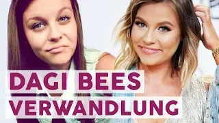 Höhen und Tiefen: Die krasse Karriere von Dagi Bee | STARS