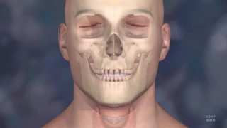 Animation of Face Transplant at the Mayo Clinic