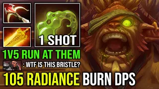 100% NEW Meta Radiance Flame Cloak 1v5 Unlimited Burning DPS Run At Them Carry Bristleback Dota 2