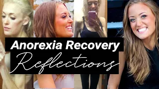 Thoughts to Help with Anorexia Recovery I TiaTravels24