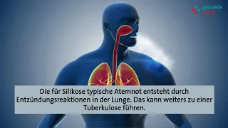 Berufskrankheit: Silikose - Wie gefährlich ist Quarzstaub wirklich?