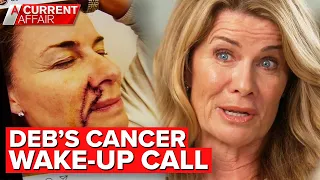 Deborah Hutton opens up on skin cancer battle | A Current Affair