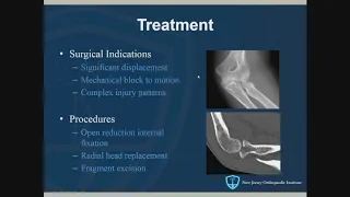 Common Elbow Fractures/Dislocations – Acute Management: John Callaghan, MD