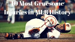 10 Most Gruesome Injuries in MLB History