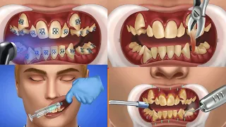 How Braces Work- Elements of the orthodontic treatment and its role#braces #orthodontics #brackets