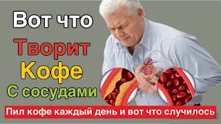 Смотрите что творит КОФЕ с СОСУДАМИ ! Реакция сосудов на КОФЕ вас очень удивит!