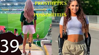 Prosthetics possibilities 39 | Prosthetic leg | Prosthetic arm | Cyborgs World