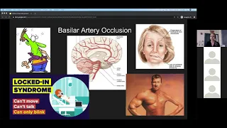 Dr  Shtridler   Clinical Pearls   Ischemic Stroke