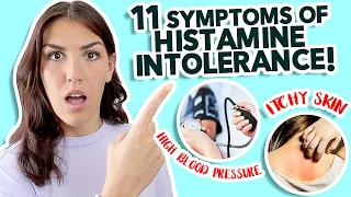 Histamine Intolerance SYMPTOMS (Watch Out for #3!)