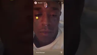 Lil uzi vert gets 24 million dollar pink diamond attached to his forehead