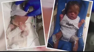 Child born without skin defies all odds
