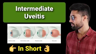 Intermediate uveitis lecture opthalmology