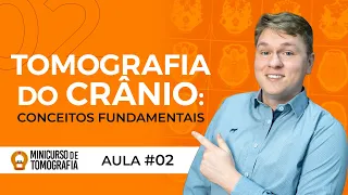 TOMOGRAFIA DO CRÂNIO - CONCEITOS FUNDAMENTAIS