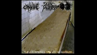 INFECTED GASTROENTERITIS - 3 Ways Of Infected Autopsy Into The Cannibalism [FULLALBUM - 2013]