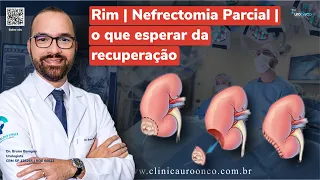 Nefrectomia Parcial | Cirurgia parcial Robótica do rim: O que Esperar da Recuperação